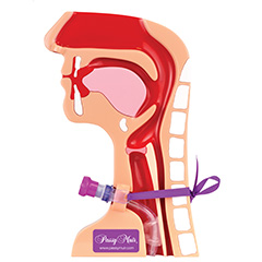 Passy Muir Tracheostomy T.O.M. Tracheostomy Observation Model