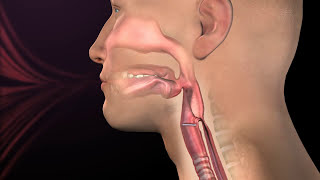 Normal Respiration and Swallow